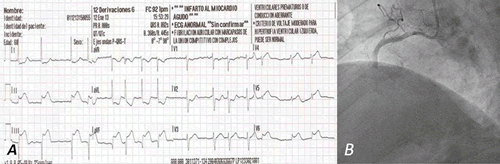 Figura 1