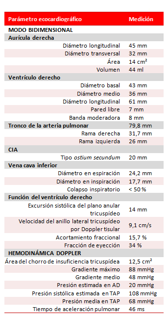 Tabla