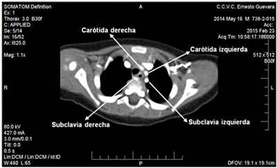 Figura 2